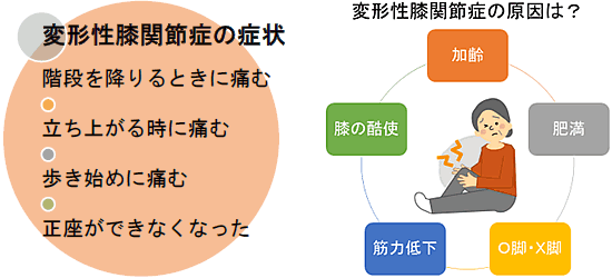 変形性膝関節症